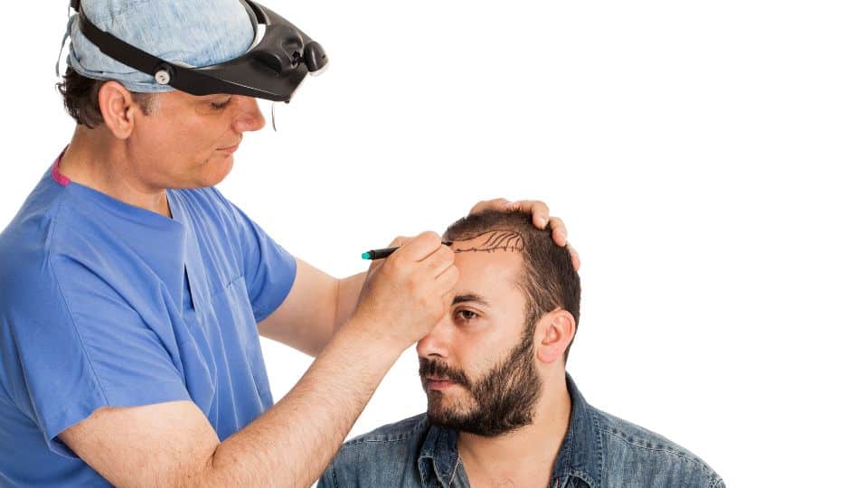 השתלת שיער – התהליך המלא