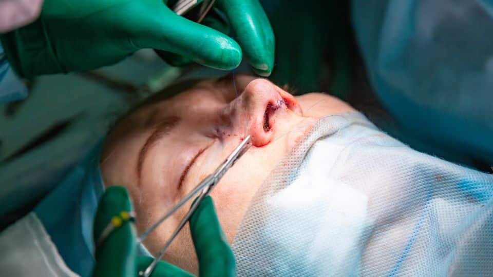 מחפשת מנתחת אף מקצועית? הכירי את ד"ר ליהי שגיא!